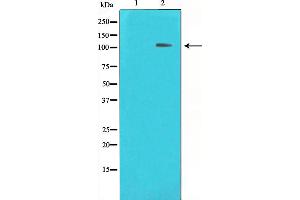 Western blot analysis on HeLa cell lysate using HDAC7 Antibody,The lane on the left is treated with the antigen-specific peptide. (HDAC7 抗体  (Internal Region))