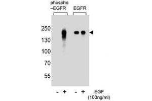 Western blot analysis of extracts from A431 cells, untreated or treated with EGF, using phospho-EGFR antibody (left) or nonphos Ab (right) (EGFR 抗体  (pTyr1172))