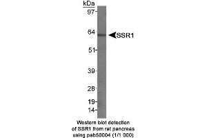 Image no. 1 for anti-Somatostatin Receptor 1 (SSTR1) (C-Term) antibody (ABIN363313) (SSTR1 抗体  (C-Term))