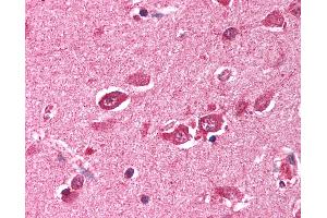 Anti-TRIM38 antibody IHC of human brain, cortex. (TRIM38 抗体  (C-Term))
