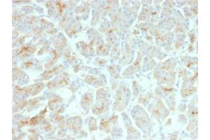 Formalin-fixed, paraffin-embedded human Pancreas stained with CFTR Mouse Recombinant Monoclonal Antibody (rCFTR/1342). (Recombinant CFTR 抗体)