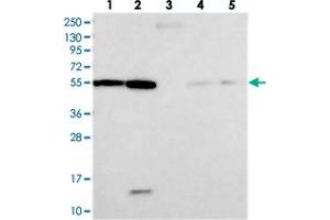 Western blot analysis of Lane 1: RT-4, Lane 2: U-251 MG, Lane 3: Human Plasma, Lane 4: Liver, Lane 5: Tonsil with DEPDC4 polyclonal antibody  at 1:250-1:500 dilution. (DEPDC4 抗体)