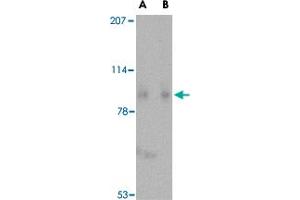 Western blot analysis of SLITRK1 in human brain tissue lysate with SLITRK1 polyclonal antibody  at (A) 1 and (B) 2 ug/mL . (SLITRK1 抗体  (C-Term))