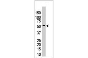 The USP14 polyclonal antibody  is used in Western blot to detect USP14 in HeLa cell lysates . (USP14 抗体  (N-Term))