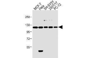 All lanes : Anti-Insulin Receptor R Antibody (N-term) at 1:2000 dilution Lane 1: 293T/17 whole cell lysate Lane 2: Hela whole cell lysate Lane 3: MCF-7 whole cell lysate Lane 4: PC-12 whole cell lysate Lane 5: SH-SY5Y whole cell lysate Lysates/proteins at 20 μg per lane. (Insulin Receptor 抗体  (N-Term))