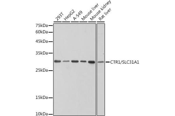 SLC31A1 抗体