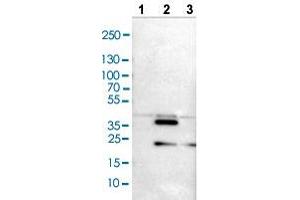 Western blot analysis of Lane 1: NIH/3T3 cell lysate, Lane 2: NBT-II cell lysate, and Lane 3: PC-12 cell lysate with CRKL polyclonal antibody . (CrkL 抗体  (AA 125-301))