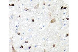 Immunohistochemistry of paraffin-embedded Rat brain using IGFBP5 Polyclonal Antibody at dilution of 1:100 (40x lens). (IGFBP5 抗体)
