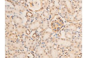 ABIN6267070 at 1/100 staining mouse kidney tissue sections by IHC-P. (NF-kB p65 抗体  (pSer536))