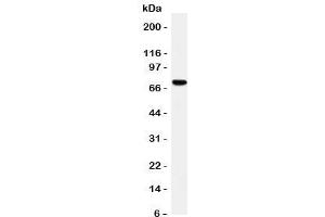 Westrn blot testing of HIF-3 alpha antibody and rat brain tissue lysate. (HIF3A 抗体  (C-Term))