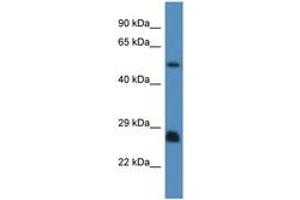 Image no. 1 for anti-SHC (Src Homology 2 Domain Containing) Transforming Protein 3 (SHC3) (AA 85-134) antibody (ABIN6746482)