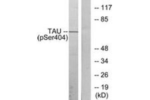 Western blot analysis of extracts from 293 cells treated with UV, using Tau (Phospho-Ser404) Antibody. (tau 抗体  (pSer721))