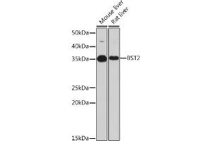 Western blot analysis of extracts of various cell lines, using BST2 Rabbit mAb (ABIN7265893) at 1:1000 dilution. (BST2 抗体)