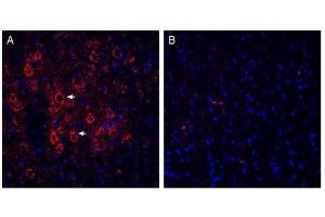 Immunohistochemistry (IHC) image for anti-Solute Carrier Family 17 (Vesicular Glutamate Transporter), Member 6 (SLC17A6) (AA 45-56), (Cytosolic) antibody (ABIN7043683)