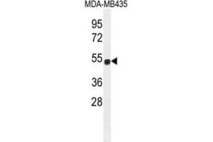 Western Blotting (WB) image for anti-Zinc Finger Protein 286B (ZNF286B) antibody (ABIN2996342) (ZNF286B 抗体)