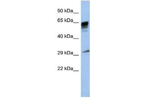 WB Suggested Anti-PRR18 Antibody Titration: 0. (Proline Rich 18 抗体  (Middle Region))