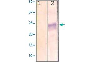 The cell lysate derived from MCF-7 was immunoprobed by RHO polyclonal antibody  at 1 : 500. (Rho-related GTP-binding protein 抗体  (C-Term))