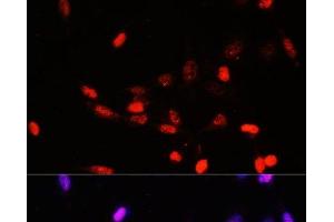 Immunofluorescence analysis of NIH/3T3 cells using COPS5 Polyclonal Antibody at dilution of 1:100. (COPS5 抗体)