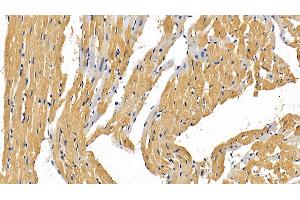 Detection of RIPK1 in Rat Cardiac Muscle Tissue using Polyclonal Antibody to Receptor Interacting Serine Threonine Kinase 1 (RIPK1) (RIPK1 抗体  (AA 1-179))