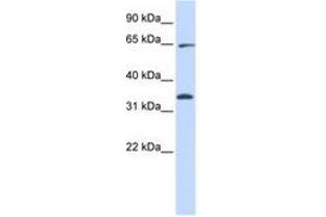 Image no. 1 for anti-Ras Homolog Gene Family, Member T1 (RHOT1) (AA 396-445) antibody (ABIN6740909) (RHOT1 抗体  (AA 396-445))