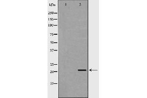 Western blot analysis of Jurkat  using RAC2 antibody. (RAC2 抗体  (C-Term))
