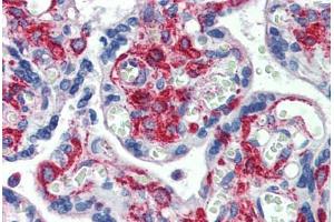 Human Placenta: Formalin-Fixed, Paraffin-Embedded (FFPE) (GPR6 抗体  (N-Term))