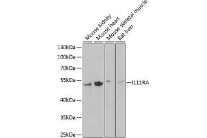 Western blot analysis of extracts of various cell lines, using IL11RA Antibody (ABIN6129037, ABIN6142294, ABIN6142295 and ABIN6222319) at 1:1000 dilution. (IL11RA 抗体  (AA 30-290))