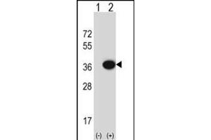 Western blot analysis of MOSC2 (arrow) using rabbit polyclonal MOSC2 Antibody (C-term) (ABIN652632 and ABIN2842422). (MARC2 抗体  (C-Term))