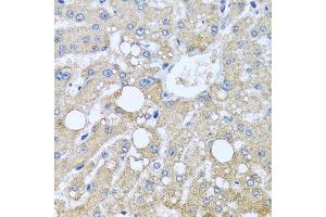 Immunohistochemistry of paraffin-embedded human liver injury using TUBGCP3 antibody at dilution of 1:100 (x40 lens). (TUBGCP3 抗体)
