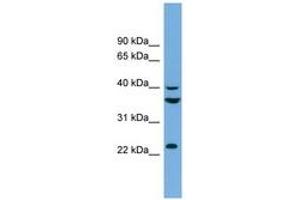 Image no. 1 for anti-SUMO1 Activating Enzyme Subunit 1 (SAE1) (AA 71-120) antibody (ABIN6743622) (SAE1 抗体  (AA 71-120))