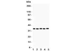 Western blot testing of HOXA11 antibody and Lane 1:  rat brain (Homeobox A11 抗体  (AA 74-245))
