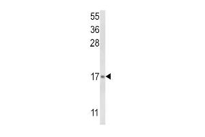 Western blot analysis of LTC4S Antibody (N-term) (ABIN652524 and ABIN2842352) in NCI- cell line lysates (35 μg/lane). (LTC4S 抗体  (N-Term))