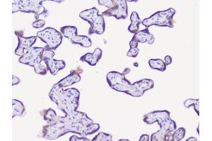 IHC analysis of NSE using anti-NSE antibody (ABIN6719549). (ENO2/NSE 抗体)