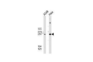 All lanes : Anti-WNK1 Antibody (C-Term) at 1:2000 dilution Lane 1: A549 whole cell lysate Lane 2: Hela whole cell lysate Lysates/proteins at 20 μg per lane. (WNK1 抗体  (AA 1848-1882))