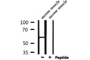 Western blot analysis of extracts from mouse muscle, using CD151 Antibody. (CD151 抗体  (N-Term))
