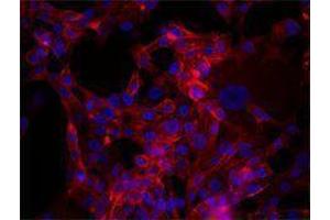 Immunofluorescence (IF) image for anti-CD44 (CD44) antibody (Alexa Fluor 647) (ABIN2657791) (CD44 抗体  (Alexa Fluor 647))