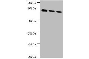 Western blot All lanes: CDH6 antibody at 6 μg/mL Lane 1: 293T whole cell lysate Lane 2: Hela whole cell lysate Lane 3: A549 whole cell lysate Secondary Goat polyclonal to rabbit IgG at 1/10000 dilution Predicted band size: 89, 74 kDa Observed band size: 89 kDa (CDH6 抗体  (AA 1-250))