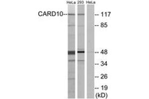 Western blot analysis of extracts from HeLa/293 cells, using CARD10 Antibody. (CARD10 抗体  (AA 481-530))