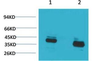 Western Blot (WB) analysis of 1) Mouse Brain Tissue, 2) Rat Brain Tissue with CABP Rabbit Polyclonal Antibody diluted at 1:2000. (S100G 抗体)