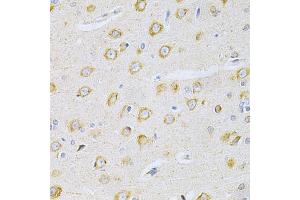 Immunohistochemistry of paraffin-embedded rat brain using OLR1 Antibody. (OLR1 抗体)