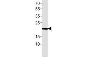 Western blot analysis of lysate from EPO recombinant protein using Erythropoietin antibody at 1:1000. (EPO 抗体  (AA 20-48))
