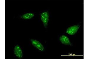 Immunofluorescence of monoclonal antibody to RNF6 on HeLa cell. (RNF6 抗体  (AA 1-100))