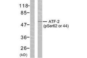Western blot analysis of extracts from HeLa cells treated with TNF-alpha, using ATF2 (Phospho-Ser62 or 44) Antibody. (ATF2 抗体  (pSer62))
