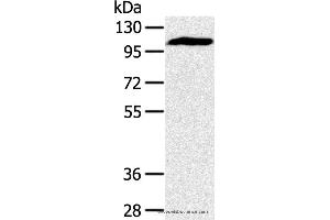 Western blot analysis of Mouse heart tissue, using PYGM Polyclonal Antibody at dilution of 1:400 (PYGM 抗体)
