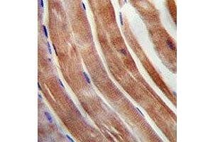 KEAP1 antibody immunohistochemistry analysis in formalin fixed and paraffin embedded human skeletal muscle. (KEAP1 抗体  (AA 422-449))