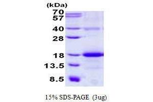 Figure annotation denotes ug of protein loaded and % gel used. (CLEC2B 蛋白)