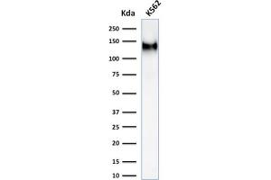 Western Blot Analysis of K562 cell lysate using CD43 Mouse Recombinant Monoclonal Antibody (rSPN/1094). (Recombinant CD43 抗体)