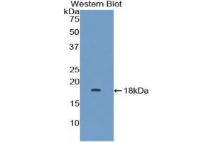 Detection of Recombinant MAPKSP1, Human using Polyclonal Antibody to Mitogen Activated Protein Kinase Scaffold Protein 1 (MAPKSP1) (MAPKSP1 抗体  (AA 1-124))
