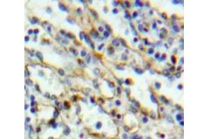 IHC-P analysis of Liver tissue, with DAB staining. (TLR6 抗体  (AA 608-796))
