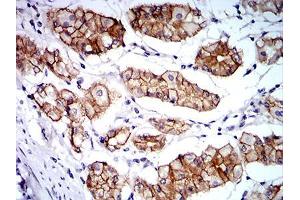 Immunohistochemistry (IHC) image for anti-Catenin (Cadherin-Associated Protein), alpha 1, 102kDa (CTNNA1) (AA 371-574) antibody (ABIN5542501)
